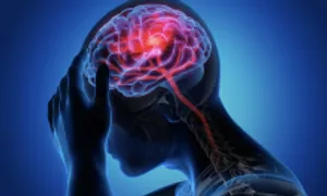12 thói quen dễ gây đột quỵ, nhồi máu cơ tim 12 thói quen dễ gây đột quỵ, nhồi máu cơ tim