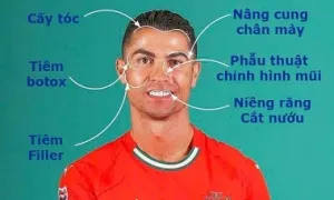 Ronaldo đã phẫu thuật thẩm mỹ bao nhiêu lần?