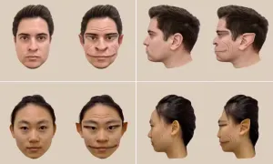 Bệnh lạ khiến người phụ nữ 'nhìn ai cũng ra rồng'