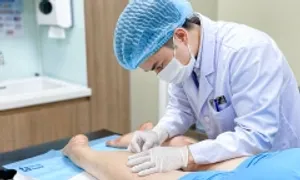 Chích xơ chữa suy giãn tĩnh mạch
