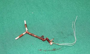 Đánh đổi sức khỏe để giữ 'phong độ' cho chồng